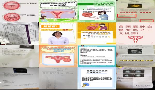 宫颈*检查费用 - 汕头宫颈*需要什么检查